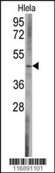 BCL2L13 Antibody (C-term)