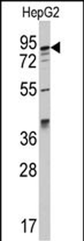 AAK1 Antibody (C-term)
