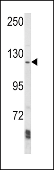 AAK1 Antibody (N-term)