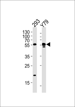 ALDH1A3 Antibody (N-term)