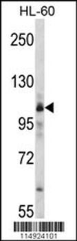 MARS Antibody (C-term)
