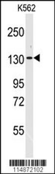 VARS Antibody (N-term)