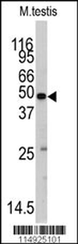 Methionyl tRNA Synthetase Antibody (C-term)