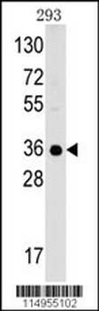 GC1qR (C1QBP) Antibody (C-term)