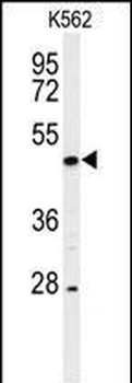 RIPK3 Antibody (C-term)