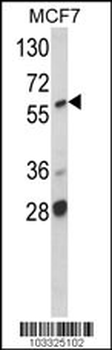 A-RAF Antibody (ARAF1) (Center)