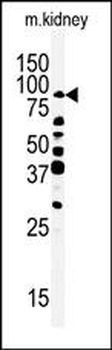 RIPK4 (ANKRD3) Antibody (C-term)