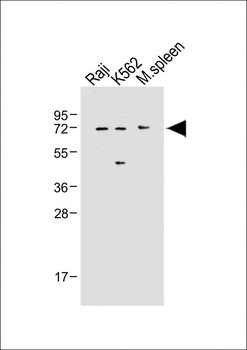 IRAK3 Antibody (N-term)
