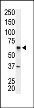 IRAK2 Antibody (N-term)