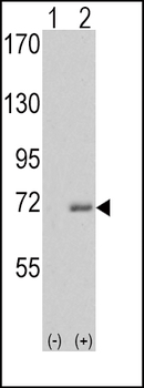 IRAK Antibody (C-term)