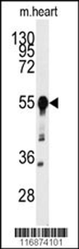 BACE1 Antibody (N-term)