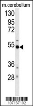 BACE Antibody (S498)