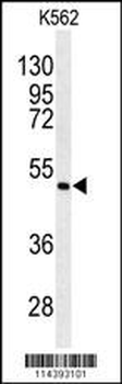 ANGPTL6 Antibody (Center)