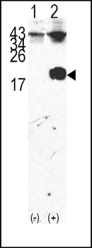 FKBP12 Antibody (Center)