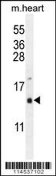 GNRH1 Antibody (N-term)