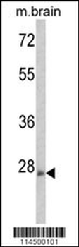 ARHE Antibody (Center)