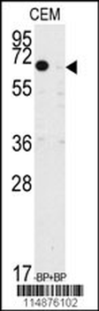 TIEG Antibody (N-term)