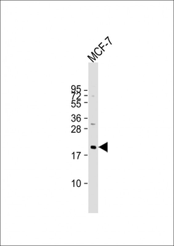 NRAS Antibody (C-term)
