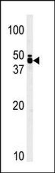 TRIB1 Antibody (C-term)