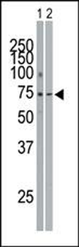 SYK Antibody (C-term)