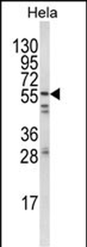 FYN Antibody (N-term)