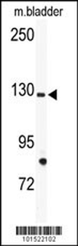 TIE Antibody (N-term)