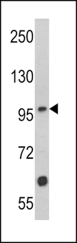 MUSK Antibody (N-term)