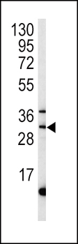 MPST Antibody (C-term)