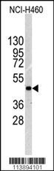 ILK Antibody (T173)