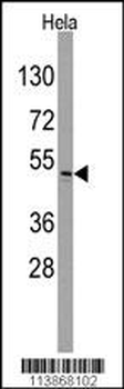 ILK Antibody (S246)
