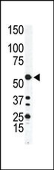 ILK1/ILK2 Antibody (N-term)