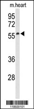 Sestrin-1 Antibody (N-term)