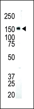 IGF1 Receptor (IGF1R) Antibody (C-term)