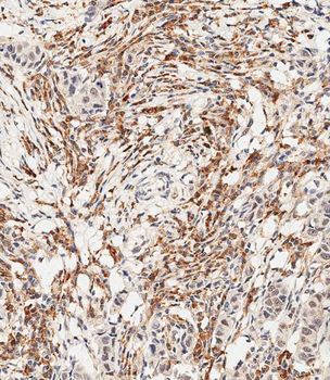 FGFR2 Antibody (C-term)