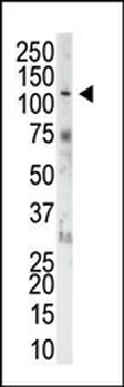 FGFR1 Antibody (N-term)