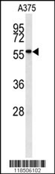 NAB2 Antibody (Center)