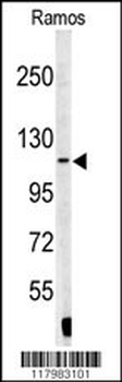 XPOT Antibody (N-term)