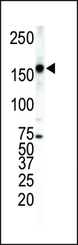 ERBB4 Antibody(C-term)