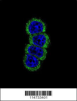 ERBB2 Antibody