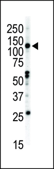 EphB2 Antibody (C-term)