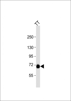 PCSK2 Antibody (N-term)