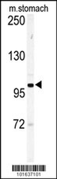 Eph Receptor A6 Antibody (C-term)