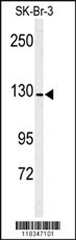 ANPEP Antibody (Center)
