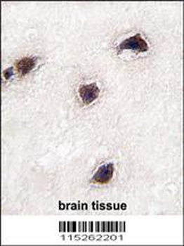 CABP1 Antibody (C-term)