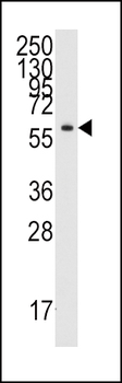 Tyrosyl tRNA synthetase (YARS) Antibody (C-term)