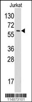 Tyrosyl tRNA synthetase (YARS) Antibody (N-term)