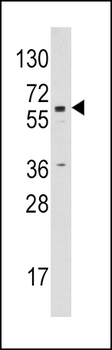 Aromatase (CYP19A1) Antibody (C-term)