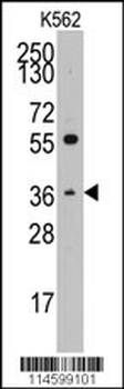 Thrombopoietin (TPO) Antibody (C-term)
