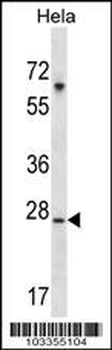 SRPK1 Antibody (N-term)