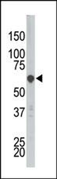 PCTAIRE3 (PCTK3) Antibody (N-term)